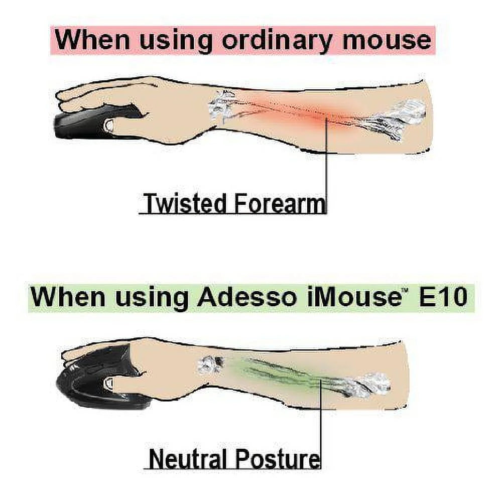 Ergo Mouse T813101